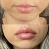 DEROL™ | Instant Lip Plumper